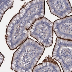 DLL4 Antibody, Novus Biologicals 0.1mL; Unlabeled:Antibodies, Polyclonal